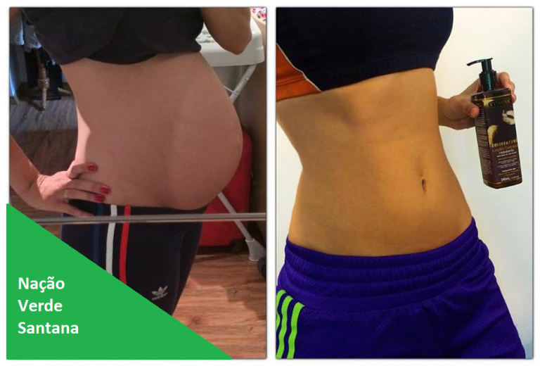 Grávidas sem estria. Marque sua vida com esse momento, mas não seu corpo!