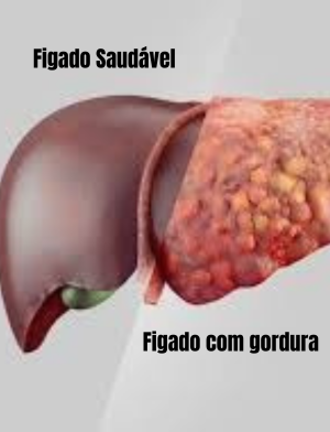 figado inflamado com um figgado saudavel